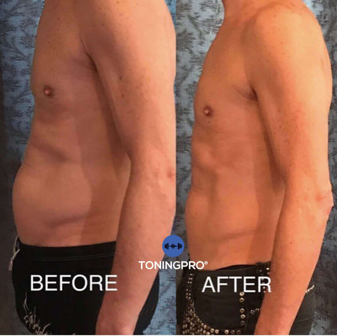 TONINGPRO® RESULTS