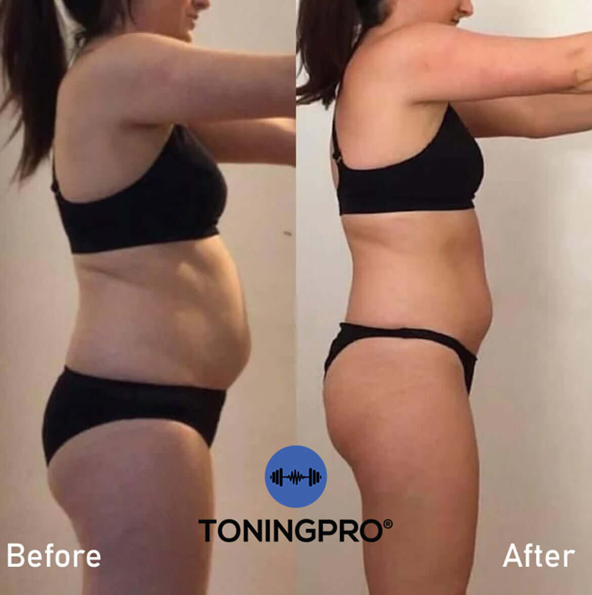 TONINGPRO® RESULTS